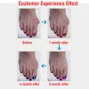 Bunion Corrector Silicone Toe Sleeves and Separator